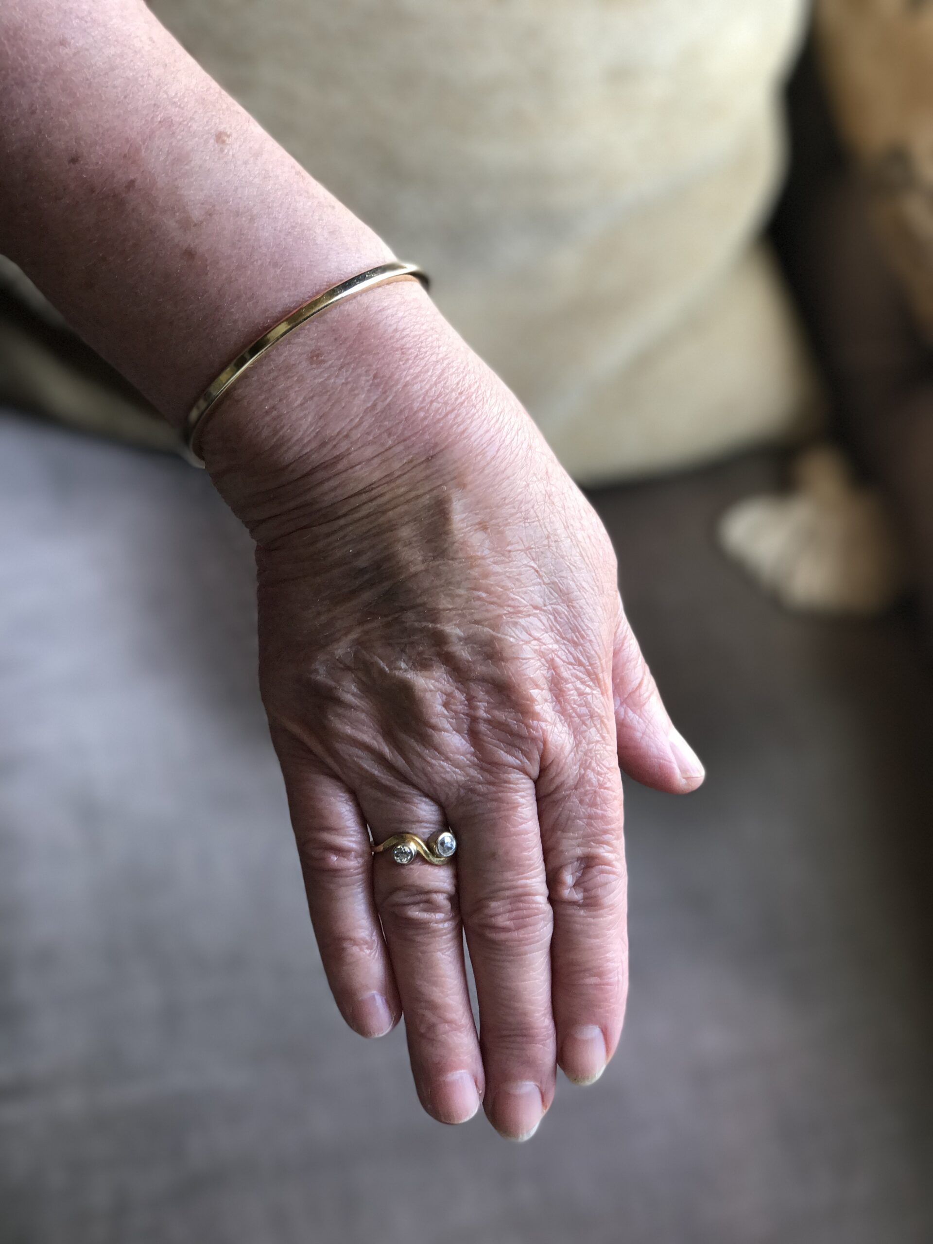 A mature white woman's right hand, back upwards with fingers straight out and closed, wearing a gold ring with two diamonds